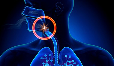 Animation of airway obstruction