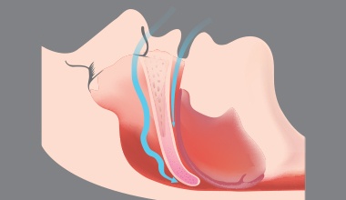 Airway animation